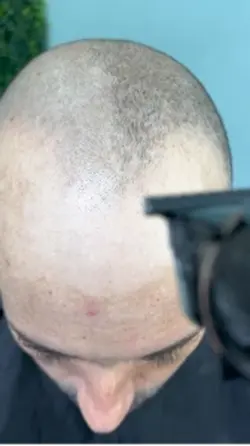 Modelo para divulgar