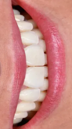 Transformação 🎯