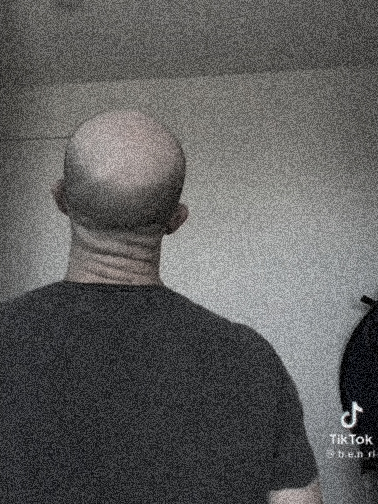Wo sind die Haare??