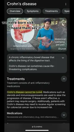 Crohn’s disease 