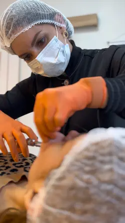 Preenchimento labial