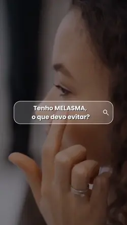 Melasma estética 