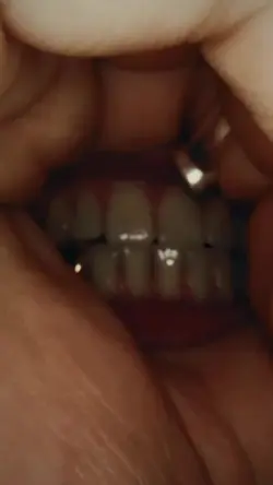 FYP