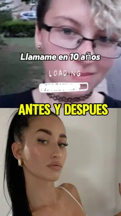 Antes y después 