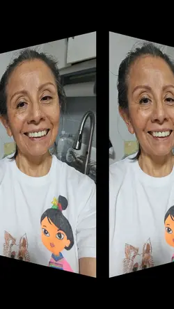 Fotos