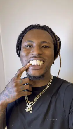 Add 15 clips