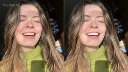 Teeth whitening