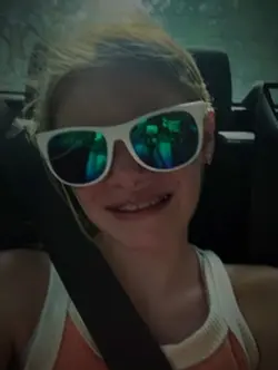 I just got my braces
